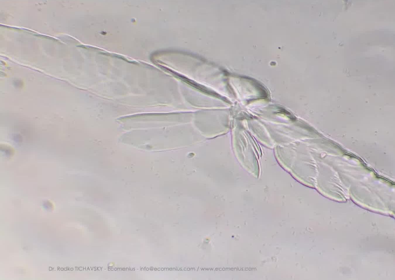 Goutte de cognac HOMEOSPIRITS séchée, vue au microscope
